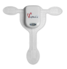 myPatch T-Patch with Holter Recorder